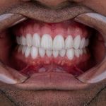 دندانپزشکی دکتر قاسم نژاد *بیمه نداریم*