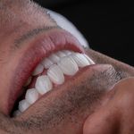 دندانپزشکی دکتر قاسم نژاد *بیمه نداریم*