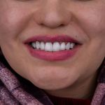 دندانپزشکی دکتر قاسم نژاد *بیمه نداریم*