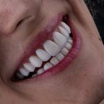 دندانپزشکی دکتر قاسم نژاد *بیمه نداریم*