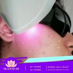 مرکز لیزر و زیبایی نیلوفر آبی رودهن