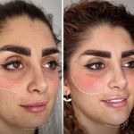 کلینیک پوست وزیبایی ومرکز تخصصی فیلربادی