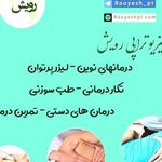 فیزیوتراپی رویش