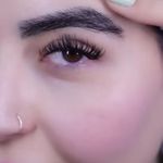 کلینیک زیبایی الماس کاملا اقساطی