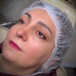 خدمات تخصصی میکروبلیدینگ  وریموو فرشته