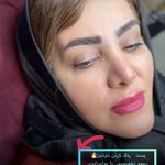 خدمات تخصصی آرایش دائم و ریموو فرشته حمیدی