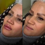 کلینیک زیبایی و لیزر نگین شرق