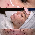 فیشیال آئورا -شبنم جلالی