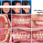 فتوگرافی پزشکی پیکس طب