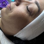 کلینیک فیشال و پاکسازی پوست تمیس