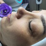 کلینیک فیشال و پاکسازی پوست تمیس