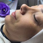 کلینیک فیشال و پاکسازی پوست تمیس