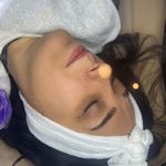 کلینیک فیشال و پاکسازی پوست تمیس