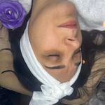 کلینیک فیشال و پاکسازی پوست تمیس