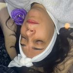 کلینیک فیشال و پاکسازی پوست تمیس