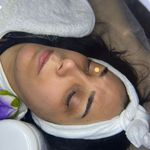 کلینیک فیشال و پاکسازی پوست تمیس