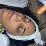 کلینیک فیشال و پاکسازی پوست تمیس