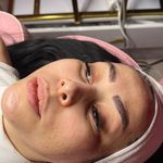 کلینیک فیشال و پاکسازی پوست تمیس