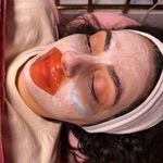 کلینیک فیشال و پاکسازی پوست تمیس