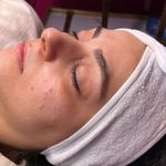 کلینیک فیشال و پاکسازی پوست تمیس