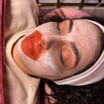 کلینیک فیشال و پاکسازی پوست تمیس