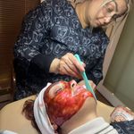 کلینیک فیشال و پاکسازی پوست تمیس