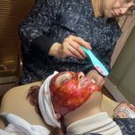 کلینیک فیشال و پاکسازی پوست تمیس