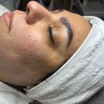 کلینیک فیشال و پاکسازی پوست تمیس