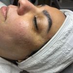 کلینیک فیشال و پاکسازی پوست تمیس