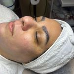 کلینیک فیشال و پاکسازی پوست تمیس