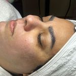 کلینیک فیشال و پاکسازی پوست تمیس