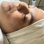 کلینیک فیشال و پاکسازی پوست تمیس