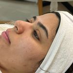 کلینیک فیشال و پاکسازی پوست تمیس