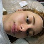 کلینیک فیشال و پاکسازی پوست تمیس