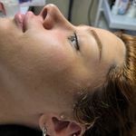 کلینیک فیشال و پاکسازی پوست تمیس