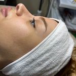 کلینیک فیشال و پاکسازی پوست تمیس