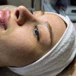 کلینیک فیشال و پاکسازی پوست تمیس