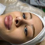 کلینیک فیشال و پاکسازی پوست تمیس