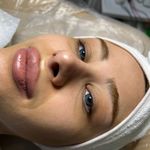 کلینیک فیشال و پاکسازی پوست تمیس