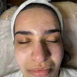 کلینیک فیشال و پاکسازی پوست تمیس