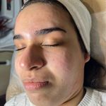 کلینیک فیشال و پاکسازی پوست تمیس