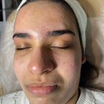 کلینیک فیشال و پاکسازی پوست تمیس