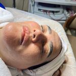 کلینیک فیشال و پاکسازی پوست تمیس