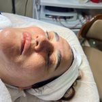 کلینیک فیشال و پاکسازی پوست تمیس