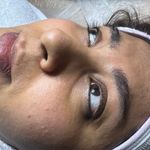 کلینیک فیشال و پاکسازی پوست تمیس