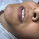 کلینیک فیشال و پاکسازی پوست تمیس