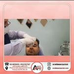 مطب زیبایی و لیزر موهای زائد اروت