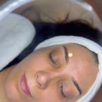 کلینیک فیشال و پاکسازی پوست تمیس