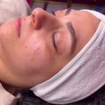 کلینیک فیشال و پاکسازی پوست تمیس