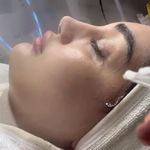 کلینیک فیشال و پاکسازی پوست تمیس